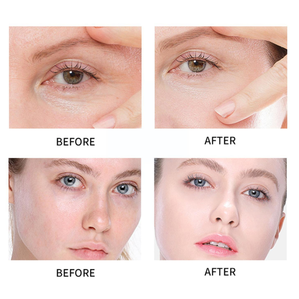 Turmeric Skin Care